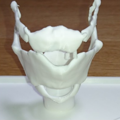 プラスチック製喉頭軟骨模型